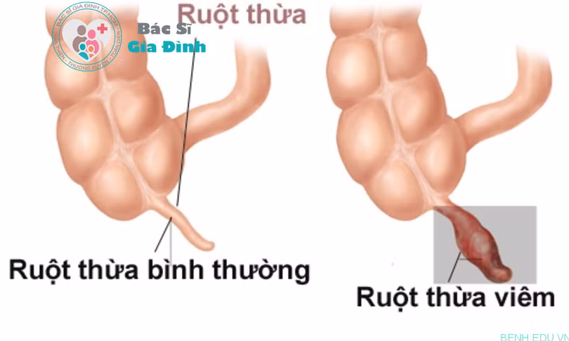 (ảnh minh họa: benh.edu.vn) (ảnh minh họa: benh.edu.vn)