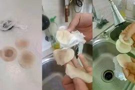 Nước sinh hoạt vàng đục kéo dài sau khi được cấp trở lại khiến người dân Chân Mây - Lăng Cô lo lắng. Ảnh Nguyễn Lê.