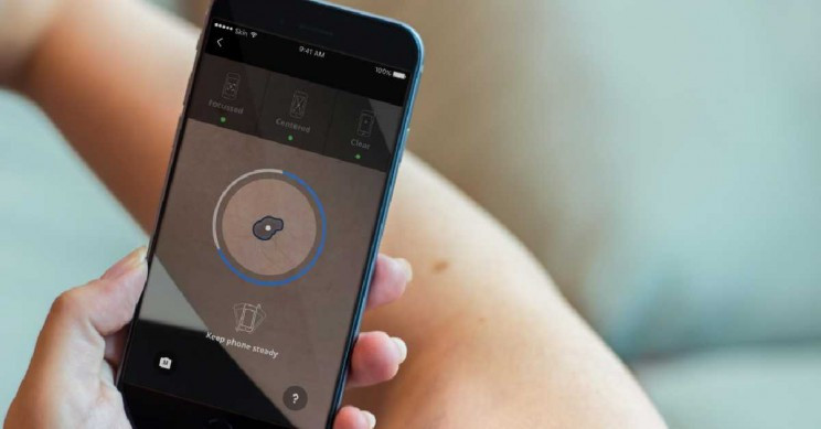 Ảnh minh họa (SkinVision) Ảnh minh họa (SkinVision)