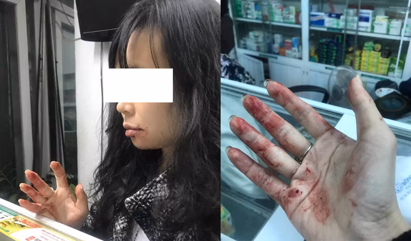 Chị N.D phản ánh bị tài xế Uber hành hung (ảnh nhân vật cung cấp)