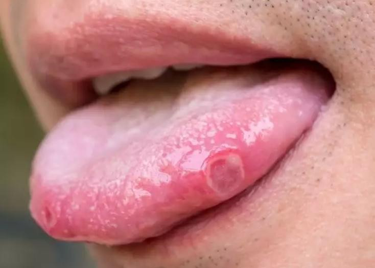 (ảnh: Times of India)