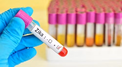 TP HCM ghi nhận 3 trường hợp nhiễm virus Zika.