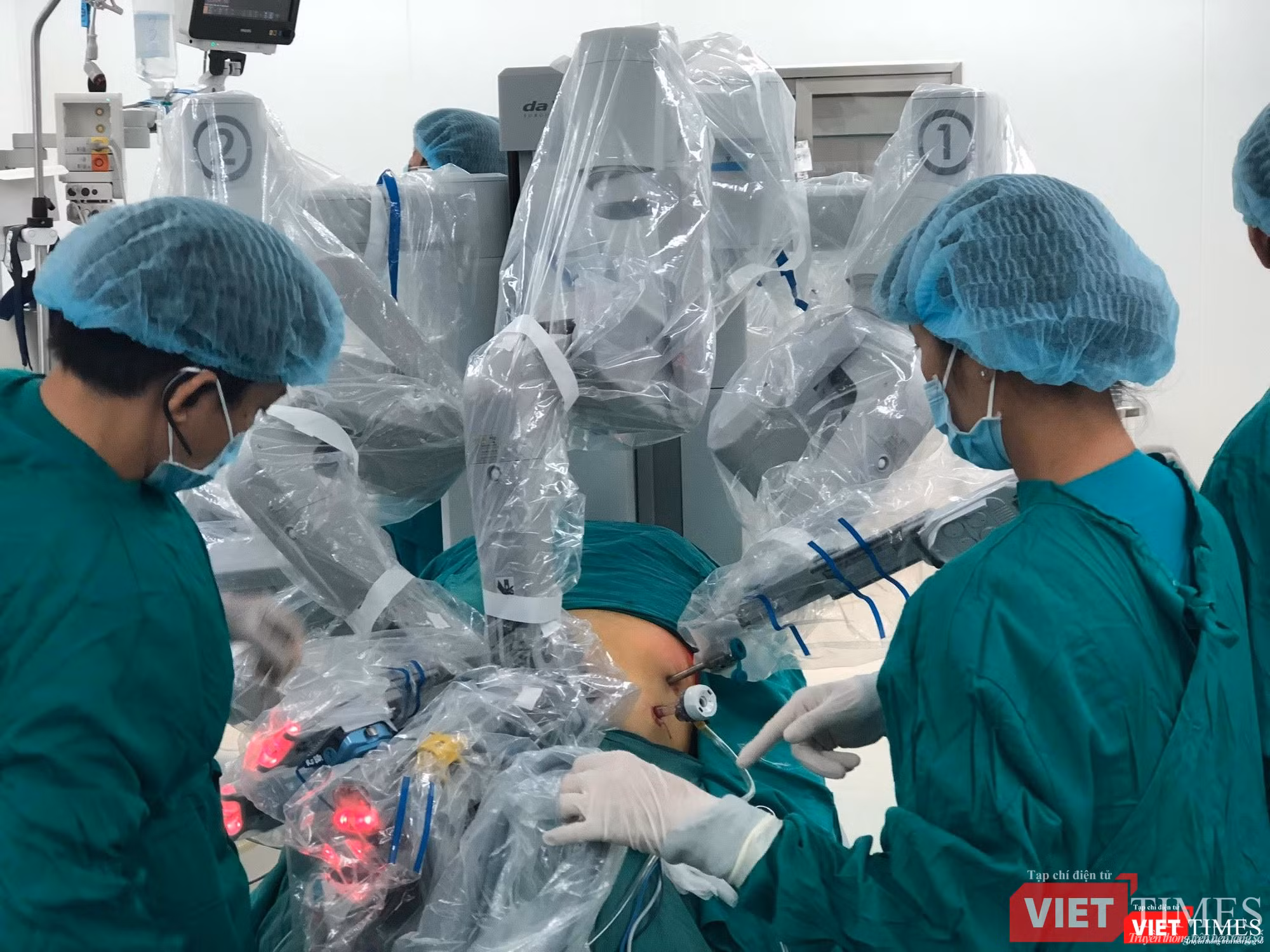 Phẫu thuật Robot ở BV Chợ Rẫy 