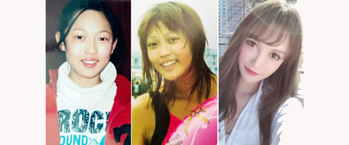 Wu Xiaochen, ảnh thuở bé, thiếu niên và hiện tại. Diện mạo của Wu đã thay đổi rất nhiều sau khi phẫu thuật thẩm mỹ Wu Xiaochen, ảnh thuở bé, thiếu niên và hiện tại. Diện mạo của Wu đã thay đổi rất nhiều sau khi phẫu thuật thẩm mỹ