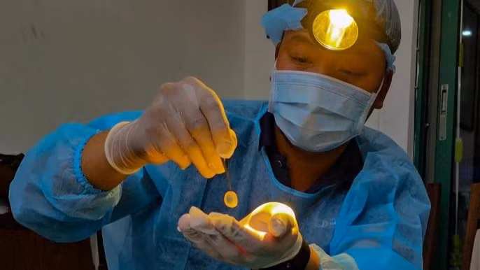 Giác mạc sinh học mở hy vọng cho hơn nửa triệu người mù tại Việt Nam