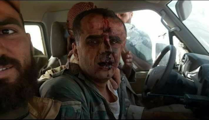 Phiến quân tuyên bố bắn hạ máy bay chiến đấu Syria, phi công bị bắt ảnh 2