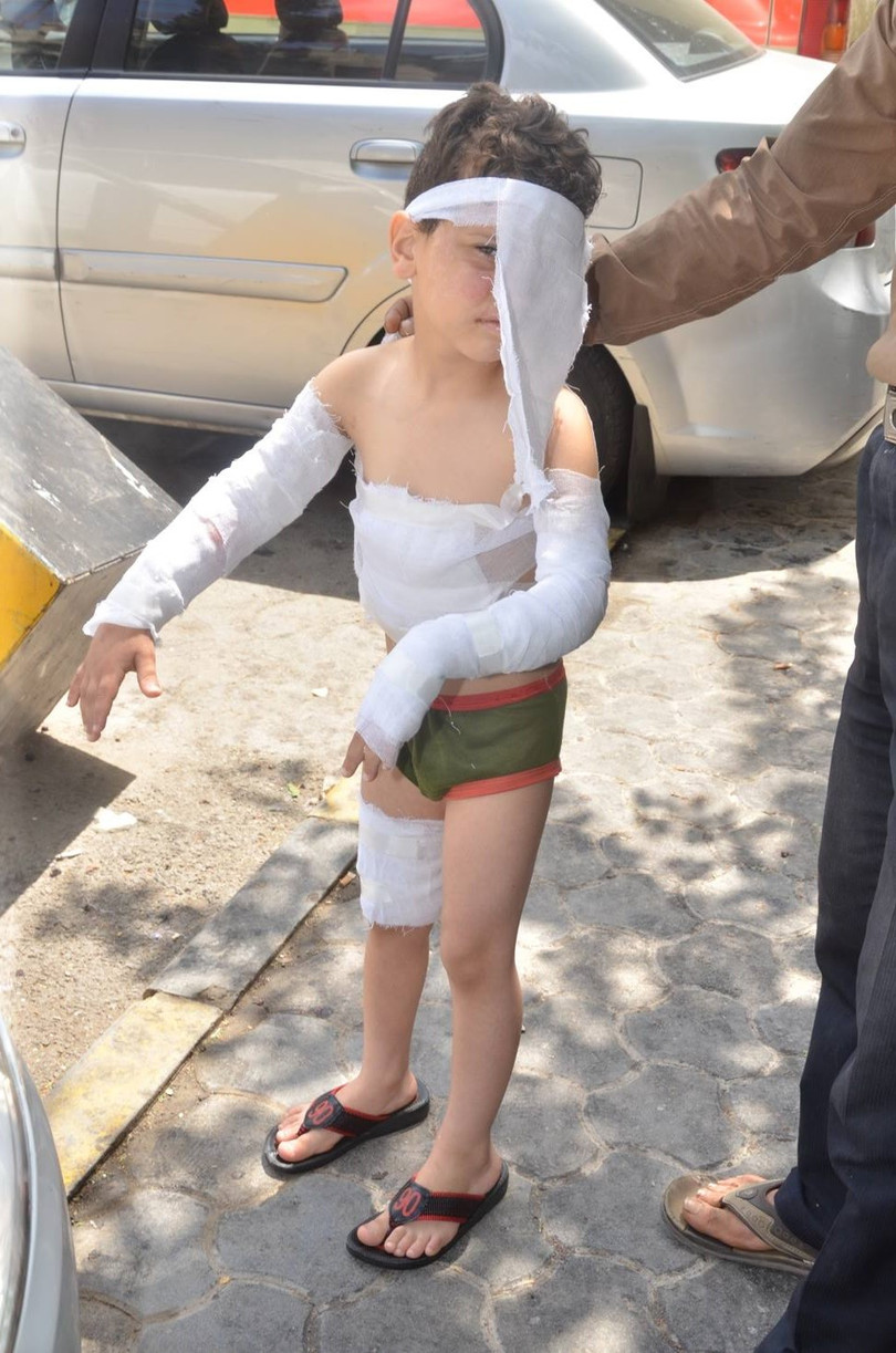 Ảnh: Thực tế đời sống của người dân Aleppo dưới mưa đạn pháo từ khủng bố Al Nusra ảnh 24