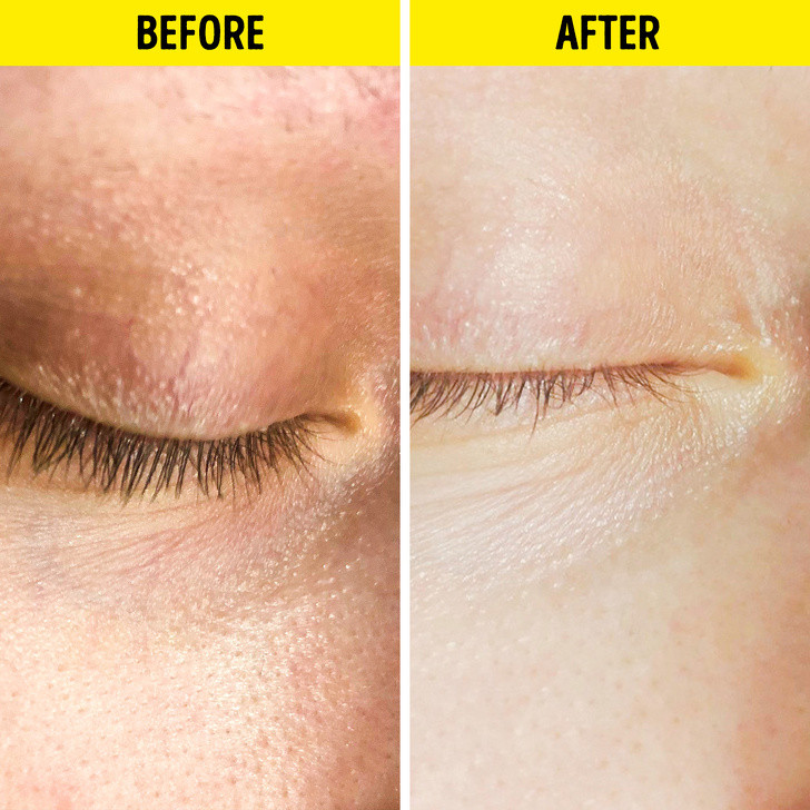 Ảnh: BrightSide Ảnh: BrightSide