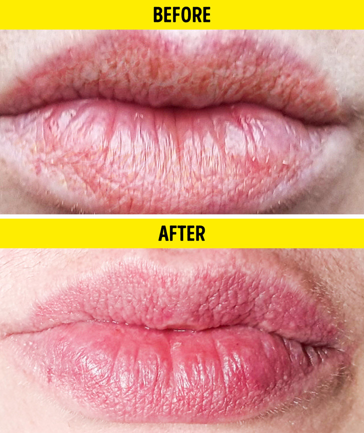 Ảnh: BrightSide Ảnh: BrightSide