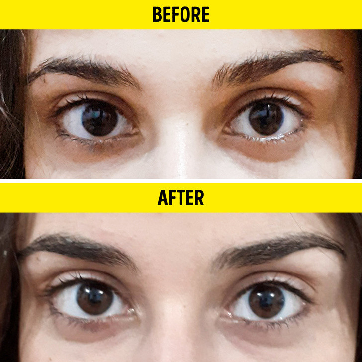 Ảnh: BrightSide Ảnh: BrightSide