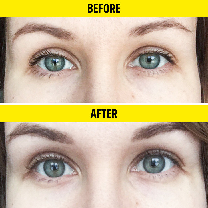 Ảnh: BrightSide Ảnh: BrightSide