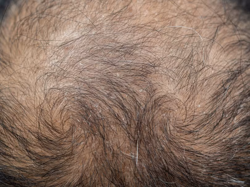 Ảnh minh họa: PM.