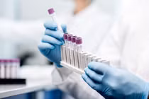Các nghiên cứu tiền lâm sàng cho thấy loại vaccine mới có thể làm nhỏ khối u và làm chậm quá trình phát triển của chúng từ 60–80%. Ảnh: Getty.