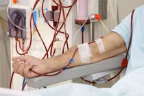 Sở Y tế TP.HCM: Chưa có bằng chứng khoa học về lọc máu phòng được đột quỵ 