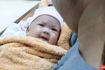 Hai bé song sinh dính liền gan tại Bệnh viện Nhi đồng 1 được xuất viện