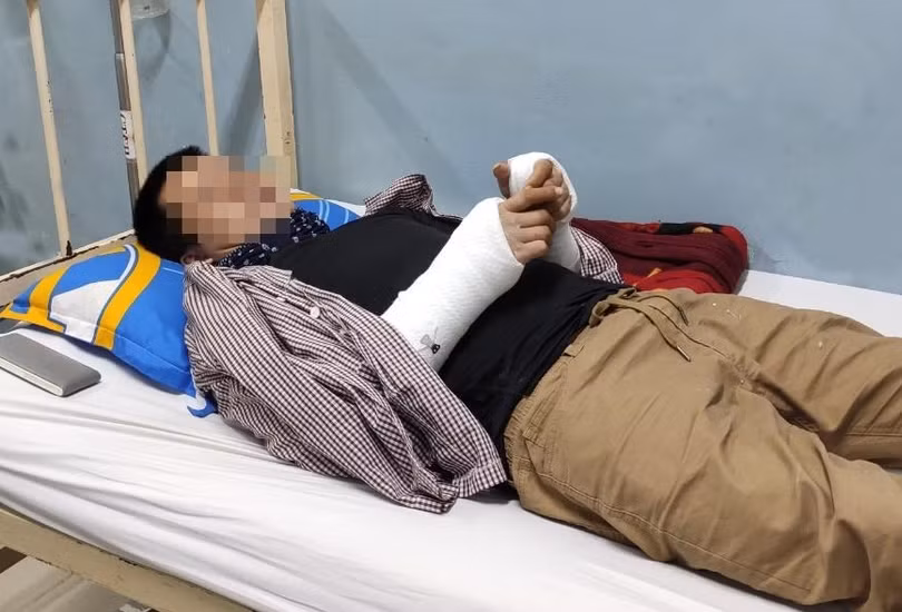 Một nạn nhân đang được điều trị tại BV Nhân dân Gia Định. Ảnh: BVCC