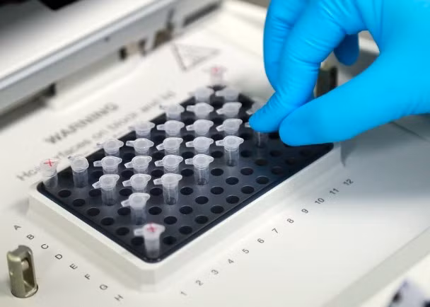 Việc nghiên cứu sản xuất vaccine đang được Trung Quốc gấp rút tiến hành và có kết quả khả quan, dự kiến đến tháng 4 sẽ được thử nghiệm lâm sàng trên người (Ảnh: Đông Phương)