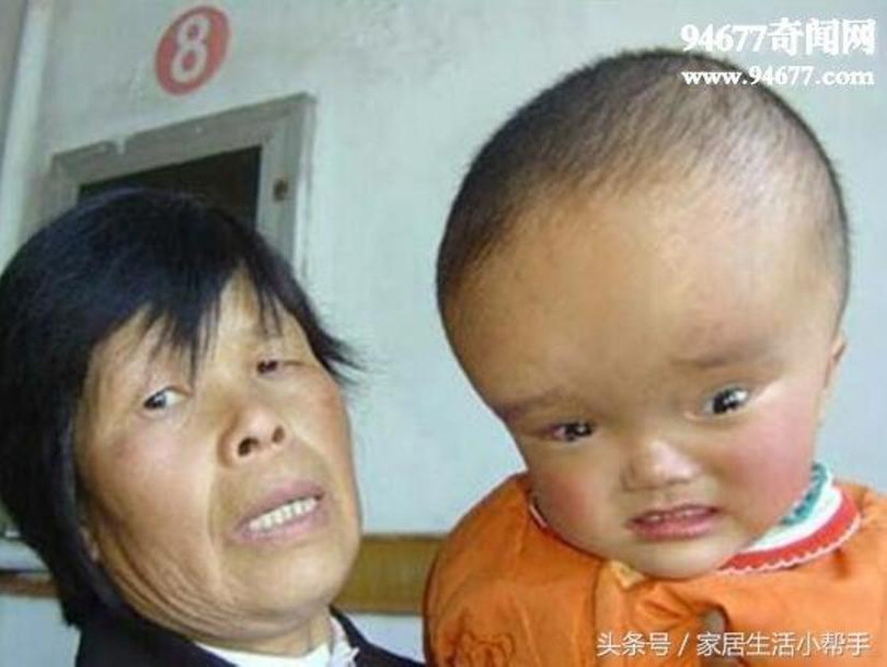 Nạn nhân của sự kiện "Sữa độc Tam Lộc" 13 năm trước nay lại tái diễn (Ảnh: Toutiao).