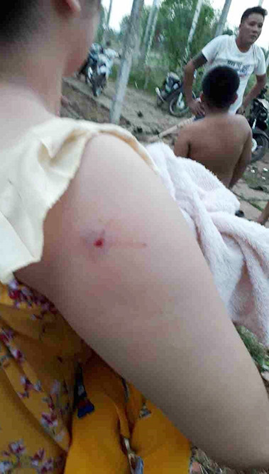 Nạn nhân trong vụ việc.