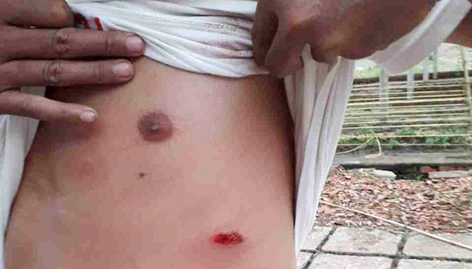 Giang hồ ngang nhiên dùng súng truy sát dân ở Củ Chi.