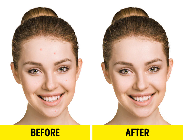 12 công dụng tuyệt vời cho cơ thể nếu bạn dùng dầu cá mỗi ngày ảnh 10