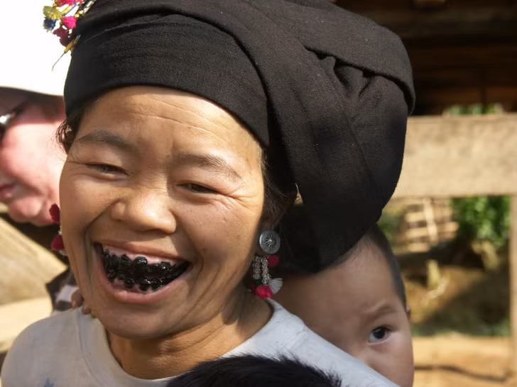 10 phương pháp làm đẹp kỳ lạ trong quá khứ ảnh 1 10 phương pháp làm đẹp kỳ lạ trong quá khứ ảnh 1