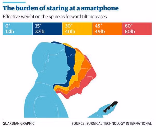 5 chứng bệnh lạ chỉ xuất hiện nhờ sự tồn tại của smartphone: hội chứng cuối gần như ai cũng từng gặp phải - Ảnh 3. 5 chứng bệnh lạ chỉ xuất hiện nhờ sự tồn tại của smartphone: hội chứng cuối gần như ai cũng từng gặp phải - Ảnh 3.