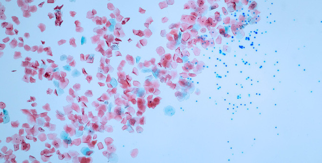 Các hạt vi nhựa có thể xâm nhập vào cơ thể người