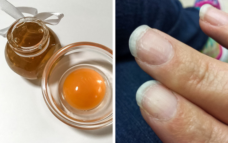 10 liệu pháp tự nhiên đối phó với móng tay yếu, dễ gãy ảnh 7 10 liệu pháp tự nhiên đối phó với móng tay yếu, dễ gãy ảnh 7