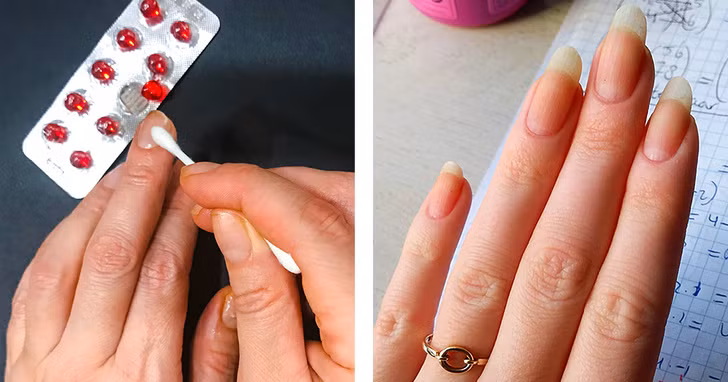 10 liệu pháp tự nhiên đối phó với móng tay yếu, dễ gãy ảnh 1