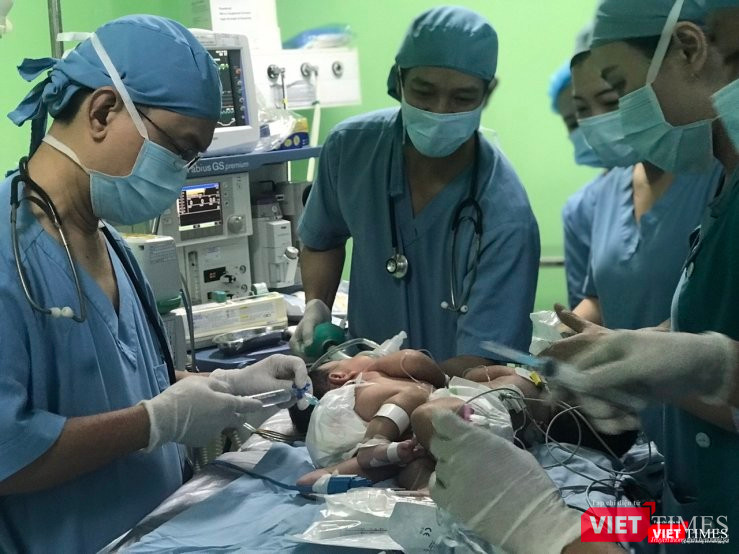 Ê kíp bác sĩ BV Nhi đồng 1 thực hiện ca mổ tách hai em bé song sinh dính liền gan. Ảnh: Thùy Dương Ê kíp bác sĩ BV Nhi đồng 1 thực hiện ca mổ tách hai em bé song sinh dính liền gan. Ảnh: Thùy Dương