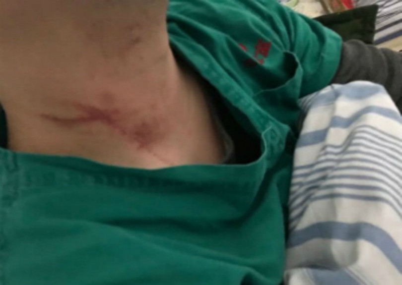 Người y tá bị người nhà bệnh nhân tấn công (Ảnh: Đông Phương). Người y tá bị người nhà bệnh nhân tấn công (Ảnh: Đông Phương).