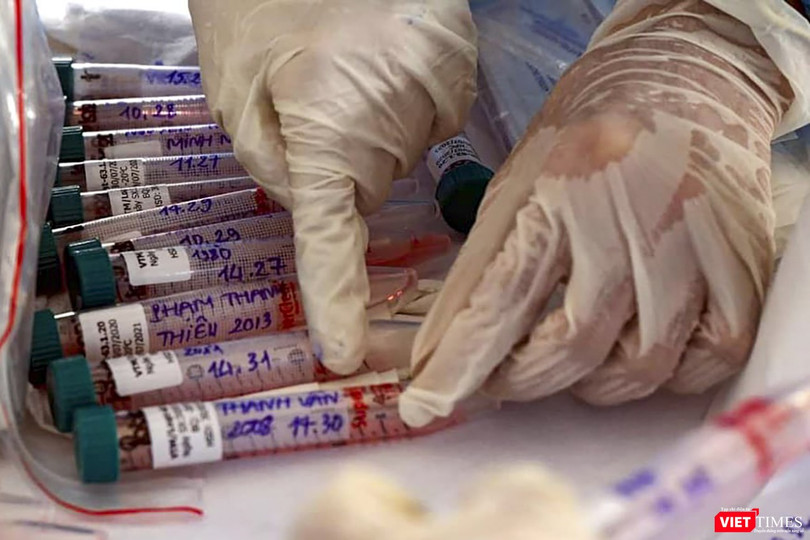 Đà Nẵng có 4 đơn vị đủ điều kiện xét nghiệm COVID-19 bằng bằng phương pháp Realtime-PCR.