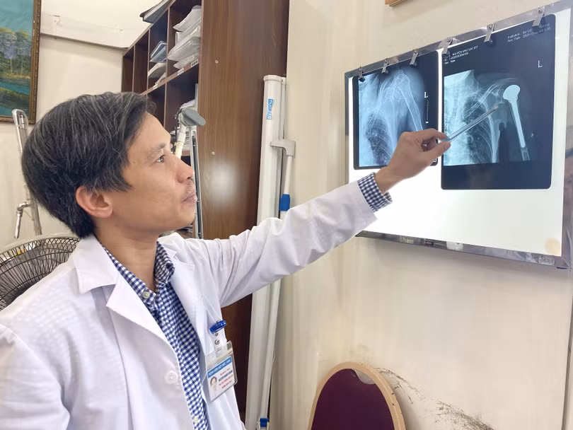 PGS.TS. Nguyễn Mạnh Khánh xem phim chụp X-quang của bệnh nhân. Ảnh: BVCC PGS.TS. Nguyễn Mạnh Khánh xem phim chụp X-quang của bệnh nhân. Ảnh: BVCC