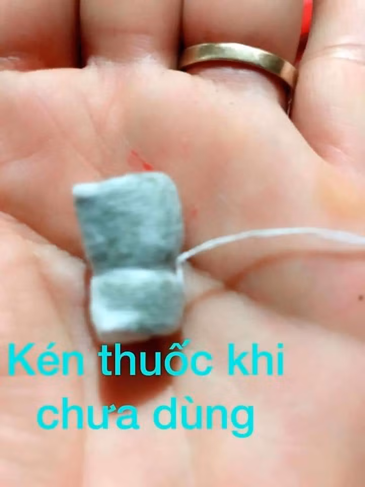 Kén thuốc khi chưa dùng (Ảnh: FB H.T) Kén thuốc khi chưa dùng (Ảnh: FB H.T)