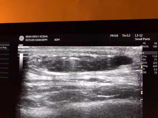 Phim chụp của bệnh nhân. Ảnh: Bệnh viện E Phim chụp của bệnh nhân. Ảnh: Bệnh viện E