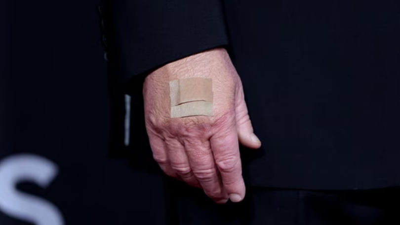 Hình ảnh cận cảnh bàn tay của ông Donald Trump khi ông tạo dáng trên thảm đỏ tại lễ trao giải Kennedy Center Honors năm 2025 ở Trung tâm Biểu diễn Nghệ thuật John F. Kennedy tại Washington, D.C. Ảnh: Reuters.