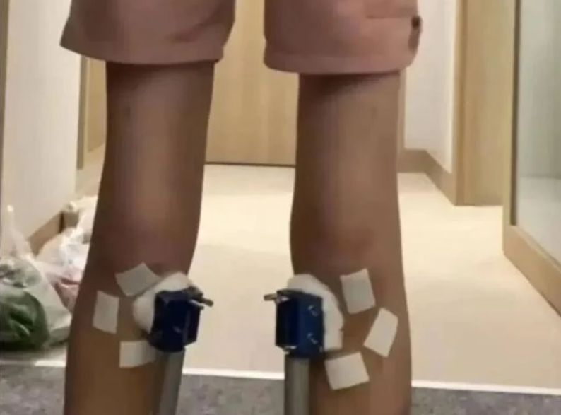 Nam sinh 16 tuổi cao thêm 1,4 cm, nhưng chỉ 2 tuần sau khi dừng trị liệu, phần tăng trưởng ấy biến mất hoàn toàn. Ảnh: OddCentral.