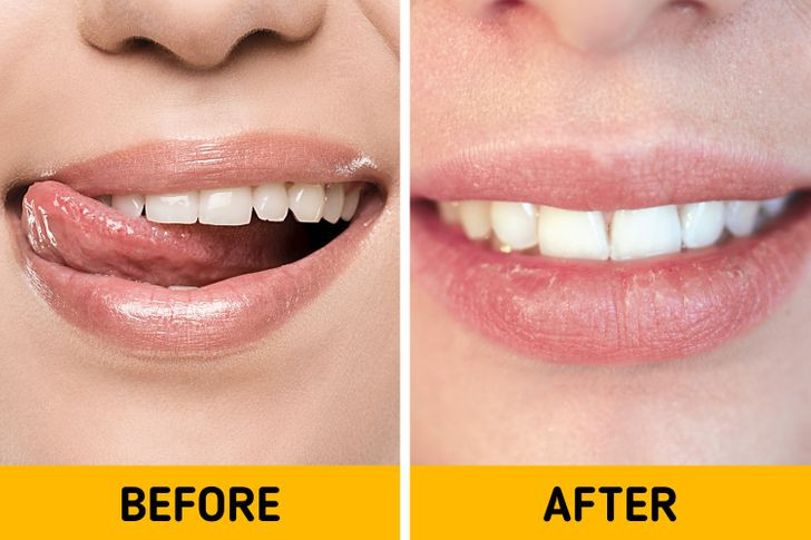 Ảnh: BrightSide Ảnh: BrightSide