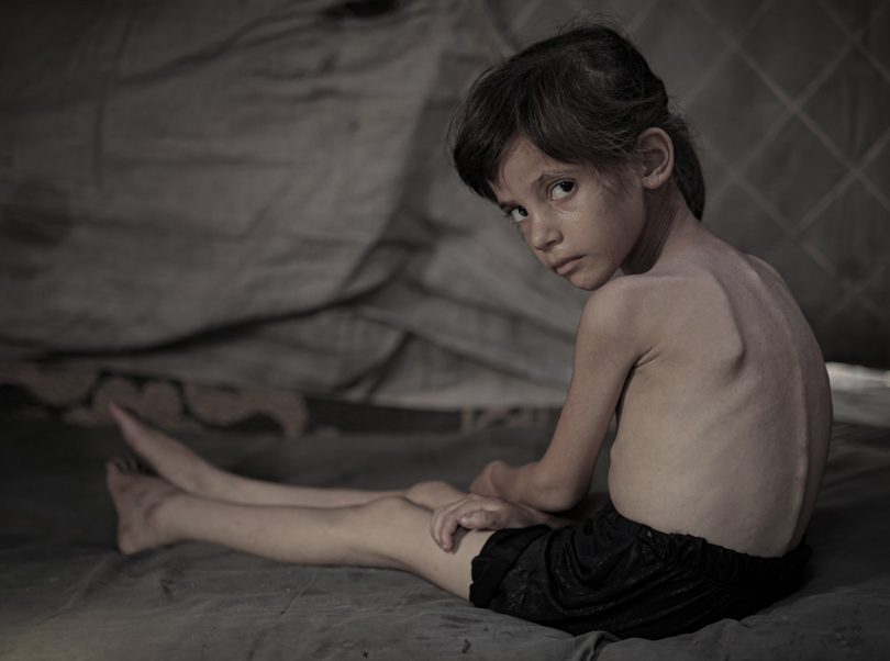 Bài toán lương thực của Israel gây ra nạn đói ở Gaza như thế nào.png