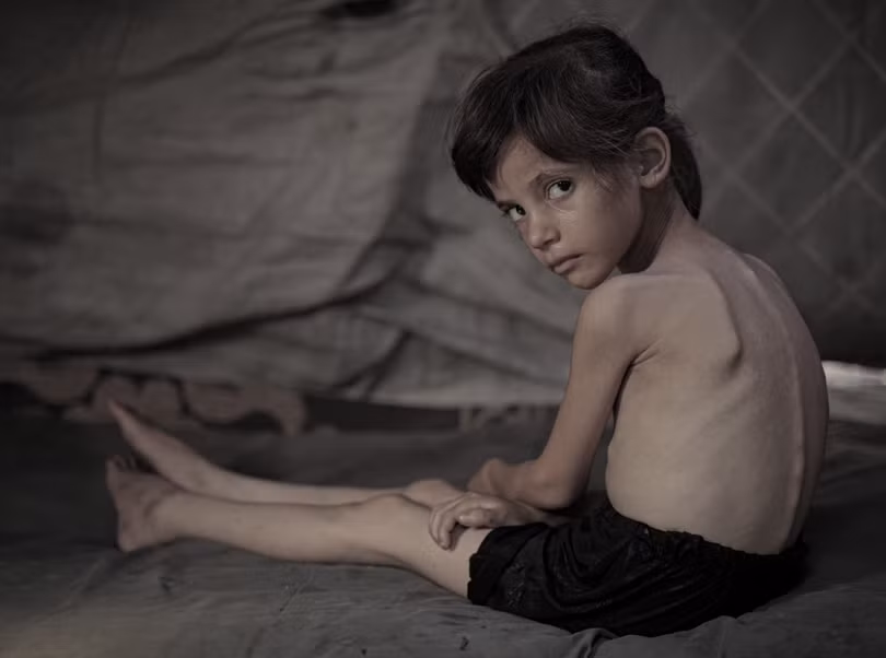 Bài toán lương thực của Israel gây ra nạn đói ở Gaza như thế nào.png