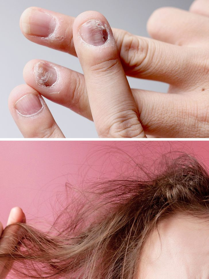 Ảnh: BrightSide Ảnh: BrightSide