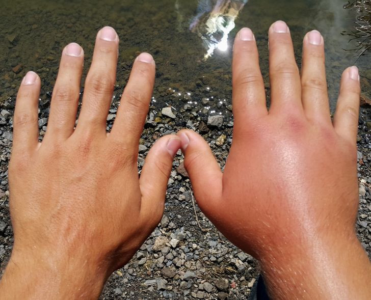 Ảnh: BrightSide Ảnh: BrightSide