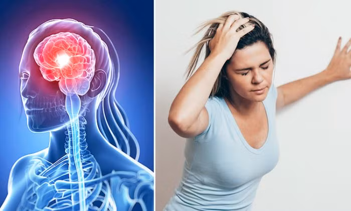 Đột quỵ não xảy ra nhanh, đột ngột, nguy hiểm, cần được chữa trị càng sớm càng tốt. Đột quỵ não xảy ra nhanh, đột ngột, nguy hiểm, cần được chữa trị càng sớm càng tốt.