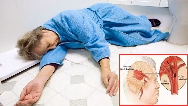 Bệnh nhân ngất xỉu khi bị đột quỵ não. Bệnh nhân ngất xỉu khi bị đột quỵ não.