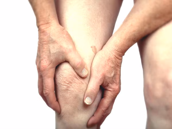 Tỏi và gừng là thực phẩm màu trắng có khả năng ngăn ngừa viêm khớp. Ảnh: Boldsky