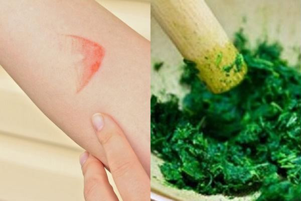 Dân gian thường dùng rau má để trị vết bỏng