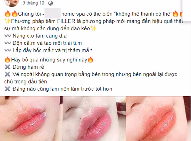 Quảng cáo tiêm filler của một spa trên địa bàn TP.HCM