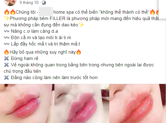 Quảng cáo về tiêm filler của một spa trên địa bàn TP.HCM