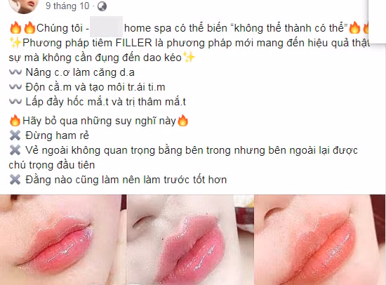 Quảng cáo về tiêm filler của một spa trên địa bàn TP.HCM